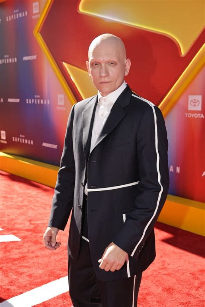 Anthony Carrigan With Hair Photos & Alopecia Condition, Fans Think Actor Might Be Battling Hair Loss