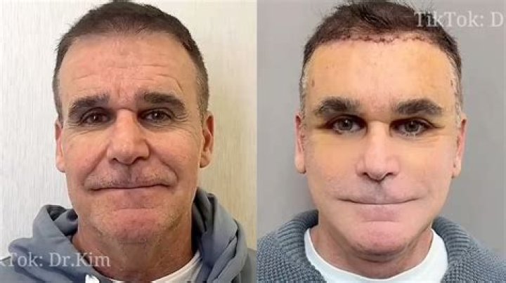 Bruna Biancardi Plastic Surgery Viral On Tiktok | Before And After Photo