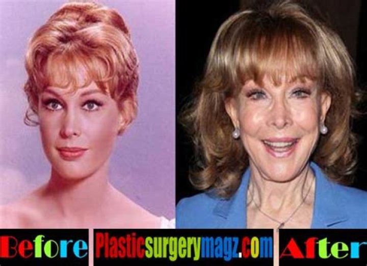 
Debi Mazar Plastic Surgery Includes Facelift Procedures 