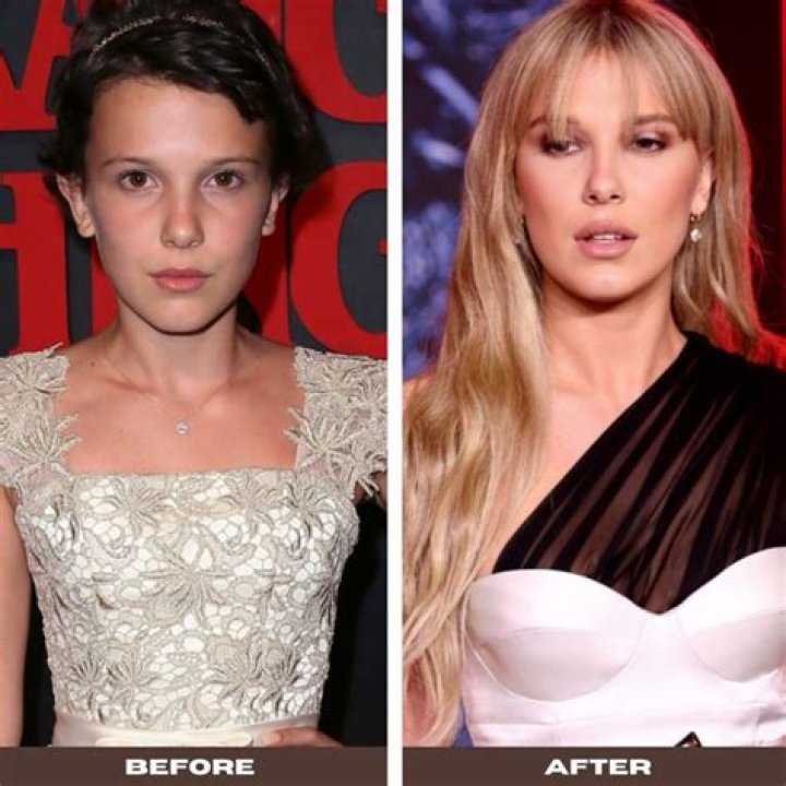 Did Millie Bobby Brown Really Get a Plastic Surgery