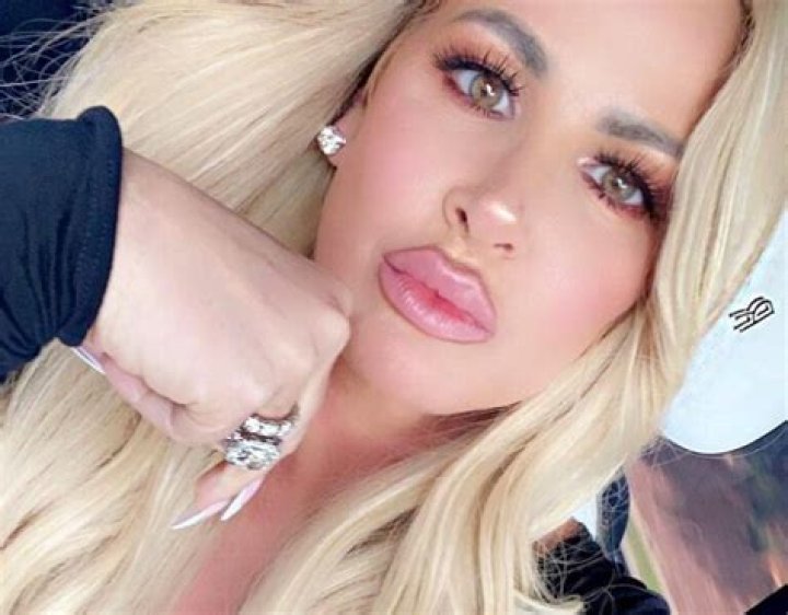 Kim Zolciak-Biermann Before Surgery Pics, Nose Job Age And Partner