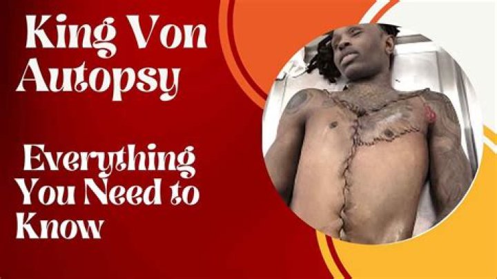 King Von Autopsy Report | Graphic Photos And Cause Of Death
