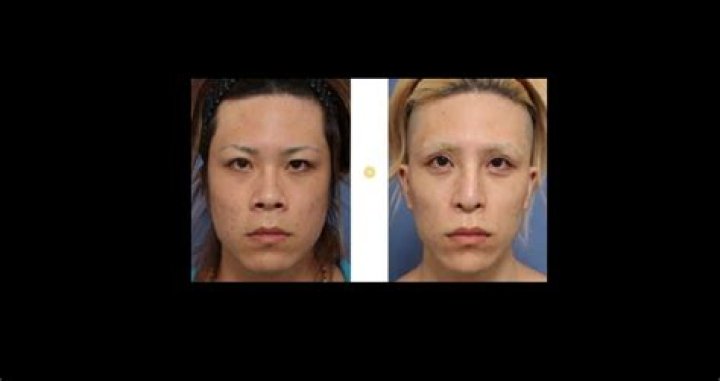 Roland Host Plastic Surgery | Before And After Pics