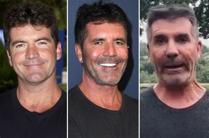 
What Happened To Simon Cowell’s Hand On AGT? Arm Injury Cause Of Accident 