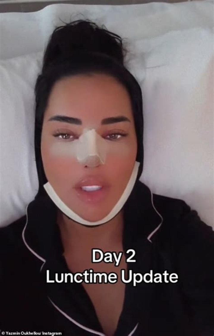 
Yazmin Oukhellou Before And After Surgery: Has She Had A Nose Job? 